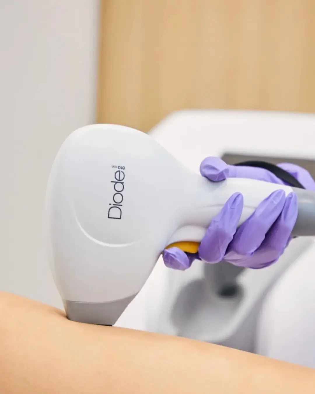 Oferta epilare definitiva Full Body cu Primelase Excellence la Kaelo Beauty Clinic Buzau