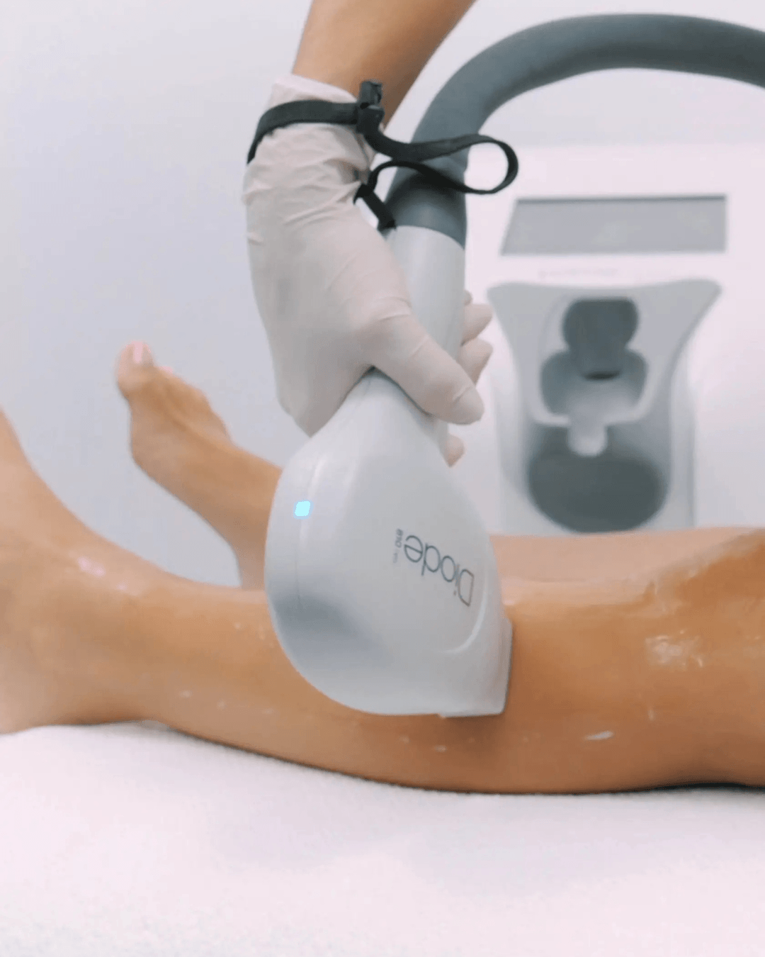 Aparat Primelase Excellence pentru epilare definitiva la Kaelo Beauty Clinic Buzau