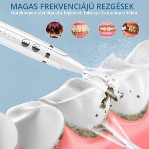 Aparat Detartraj Zenkabeat Smart Sonic Pro Ultrasonic - Img 4