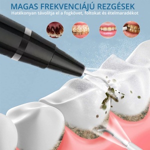 Aparat Detartraj Zenkabeat Smart Sonic Pro Ultrasonic - Img 4