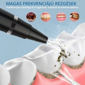 Aparat Detartraj Zenkabeat Smart Sonic Pro Ultrasonic - Img 4