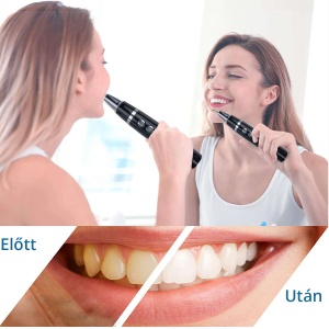Aparat Detartraj Zenkabeat Smart Sonic Pro Ultrasonic - Img 5