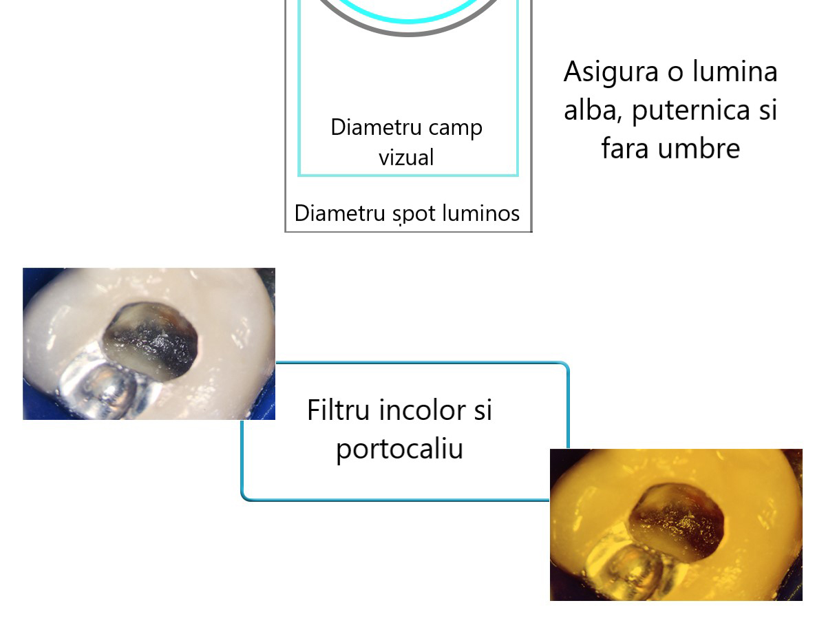 microscop-endodontic-chirurgical-8