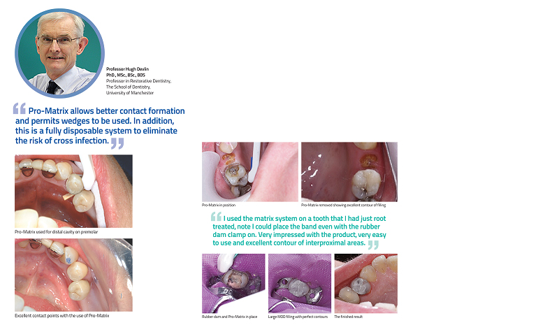 matrice promatrix estetic 4