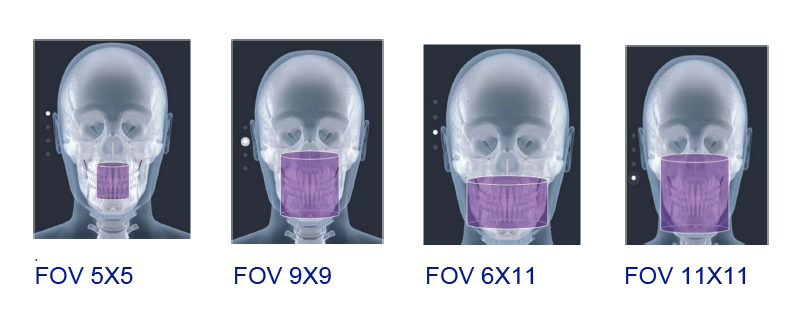 FOV aparat radiologie dentară OPERA 3D