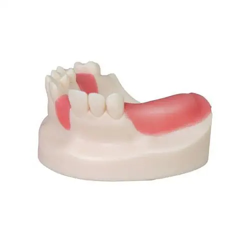 Modele pentru implant dentar - Img 7