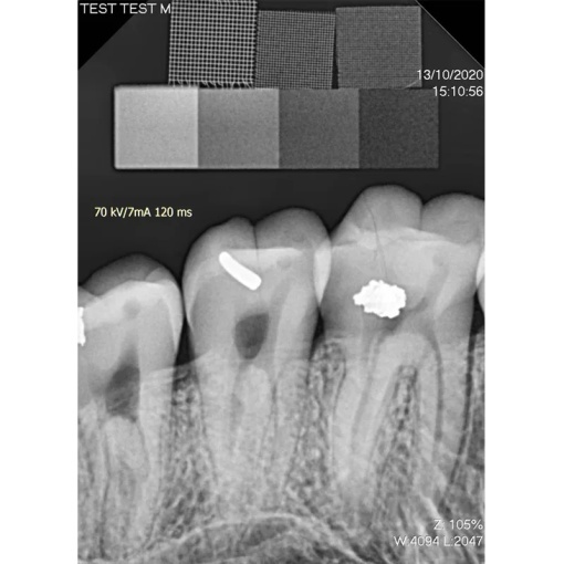 Senzor intraoral radiologic Digisens HD - Img 5