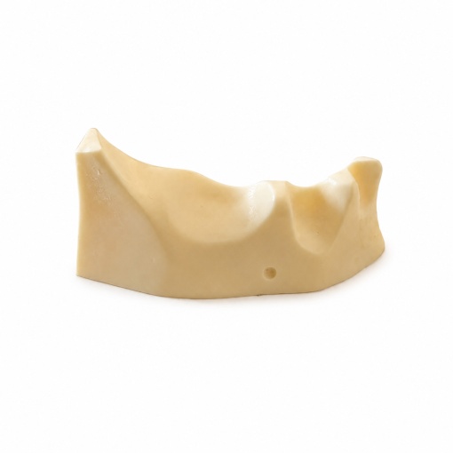 Modele mandibulare pentru implant dentar - Img 7
