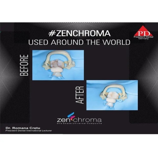 Zenchroma compozit universal Refill Opaquer 4g President - Img 4