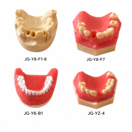 Modele pentru implant dentar - Img 10