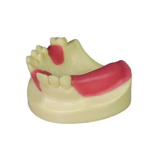 Modele pentru implant dentar rapid - Img 2