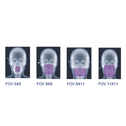 Aparat de radiologie dentară OPERA 3D - Img 5