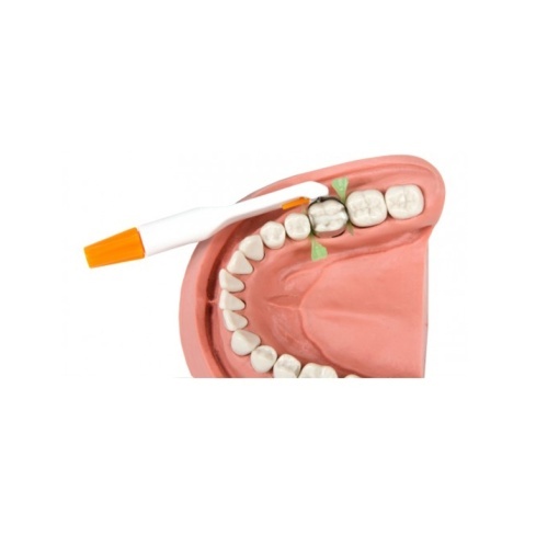 Matrice ProMatrix Estetic molar (portocaliu) - Img 2