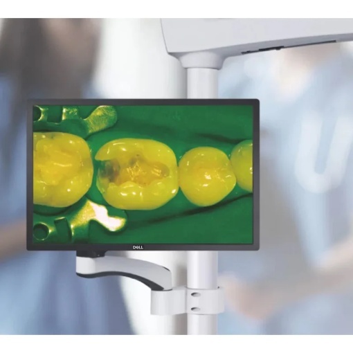 Microscop endodontic C-Clear 2 Coxo cu camera Sony 4K inclusa - Img 4