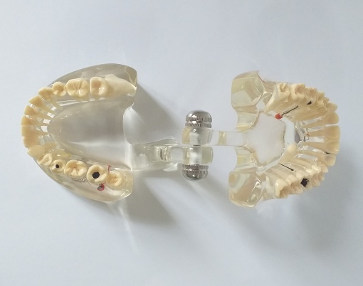 Model dentar patologic C4 - Img 3
