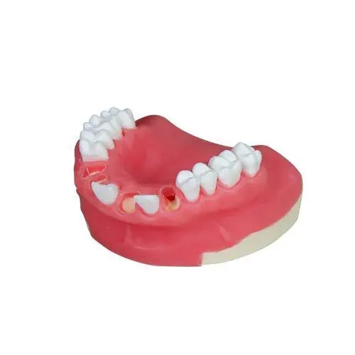 Modele pentru implant dentar - Img 5