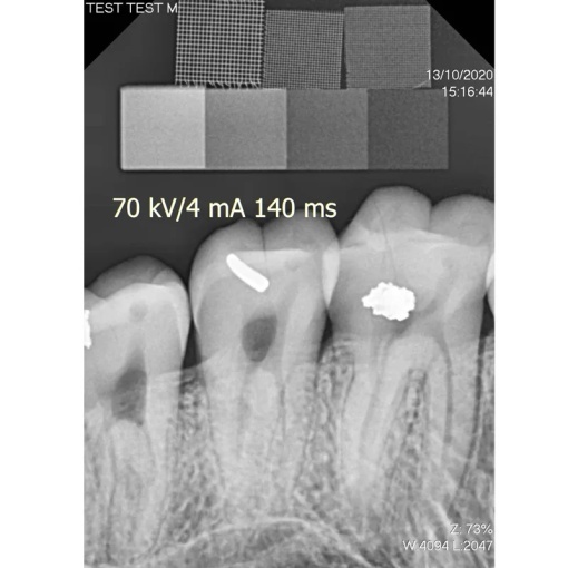 Senzor intraoral radiologic Digisens HD - Img 4