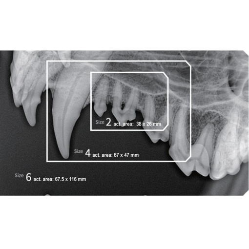 Senzor intraoral radiologic Digisens HD - Img 9