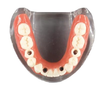 Modele dentare diverse si acesorii - Img 2