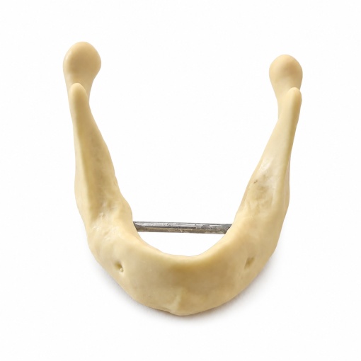 Modele mandibulare pentru implant dentar - Img 5