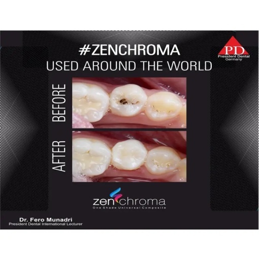 Zenchroma compozit universal Refill Opaquer 4g President - Img 2