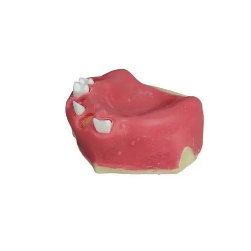 Modele pentru implant dentar rapid - Img 3