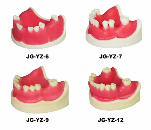 Modele pentru implant dentar - Img 9