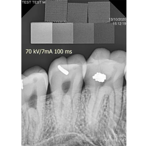 Senzor intraoral radiologic Digisens HD - Img 6