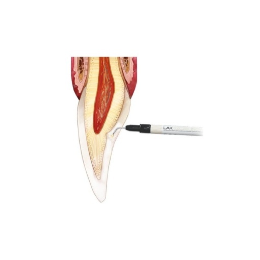 Sigilant dentar nanohibrid fotopolimerizabil Arkona Sealprim, seringă 1g - Img 3