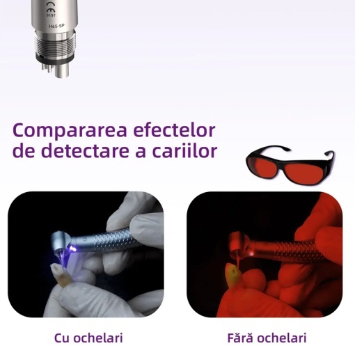 Turbina dentara CX207-F H65-TP M4 Led cu detectie carie Coxo - Img 2