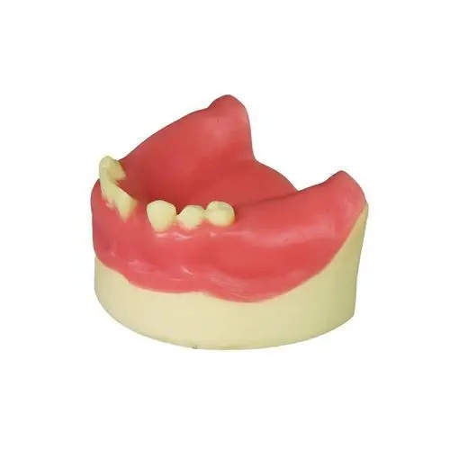 Modele pentru implant dentar - Img 6