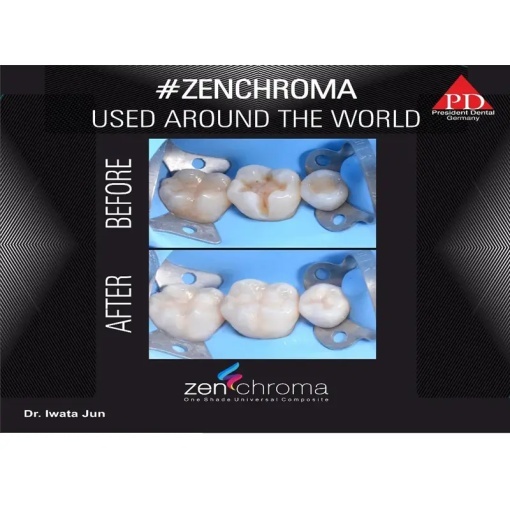 Zenchroma compozit universal Refill Opaquer 4g President - Img 5