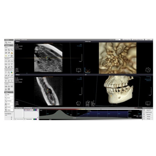 Aparat de radiologie dentară OPERA 3D - Img 4