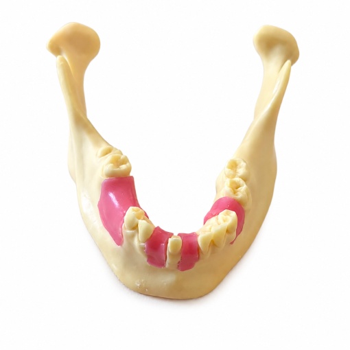Modele mandibulare pentru implant dentar - Img 6
