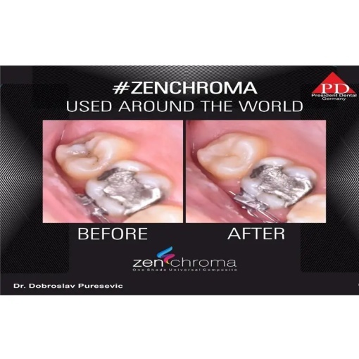Zenchroma compozit universal Refill Opaquer 4g President - Img 3