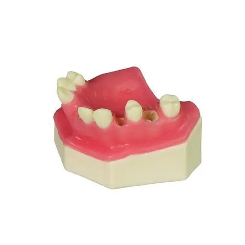 Modele pentru implant dentar rapid - Img 4