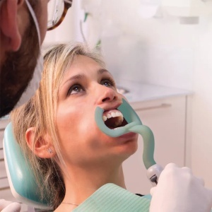 Departator bucal cu aspiratie OBF - vezi oferta