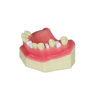 Modele dentare pentru ridicarea sinusului