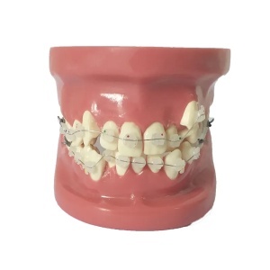 Model dentar orthodontic B3