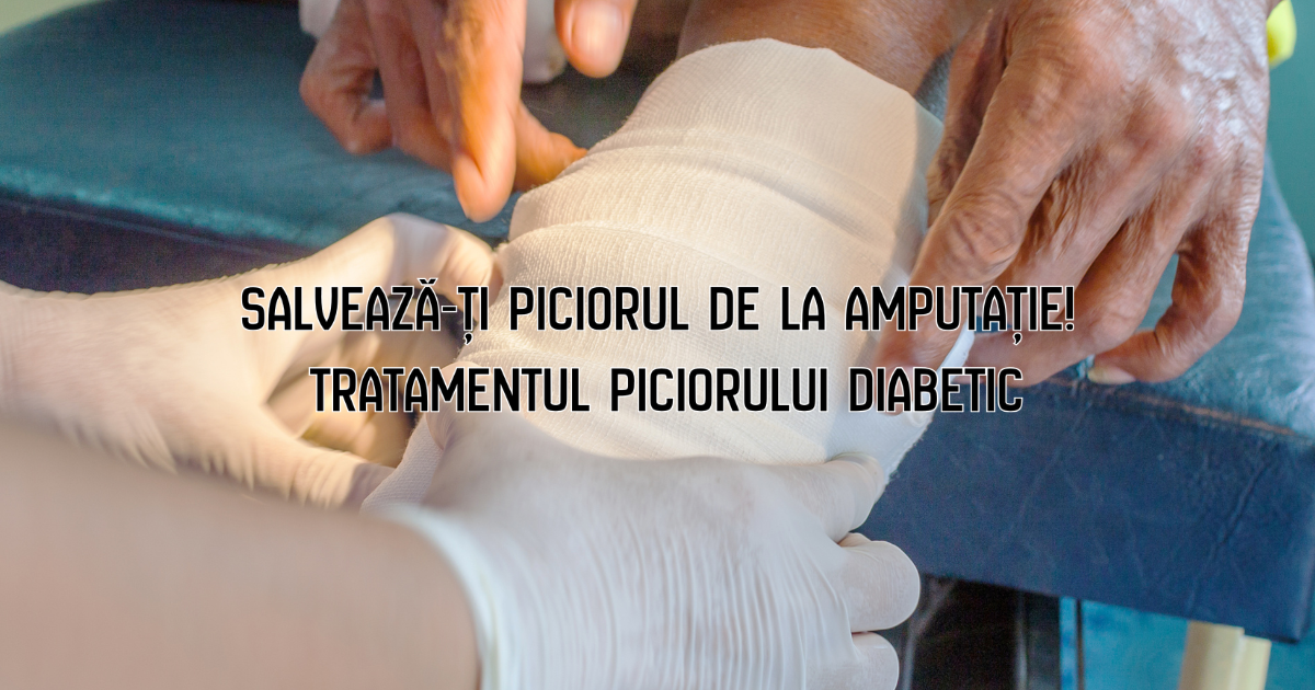 Salvează-ți piciorul de la amputație! Tratamentul piciorului diabetic