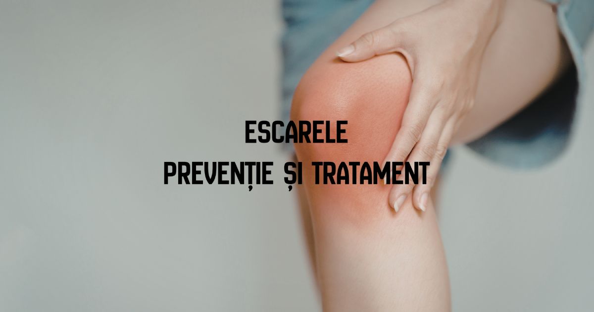 Escarele – prevenție și tratament