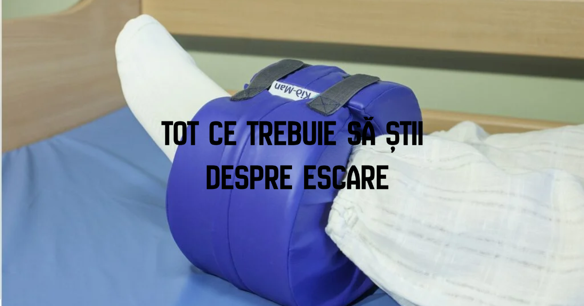 Tot ce trebuie să știi despre escare