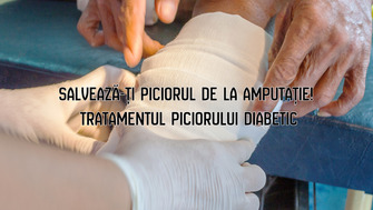 Salvează-ți piciorul de la amputație! Tratamentul piciorului diabetic