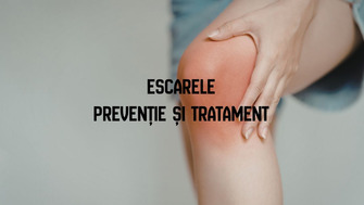 Escarele – prevenție și tratament