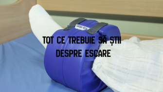 Tot ce trebuie să știi despre escare