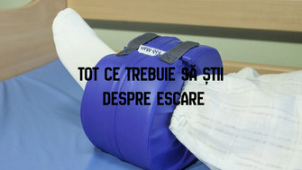 Tot ce trebuie să știi despre escare