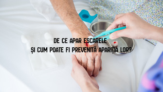 De ce apar escarele și cum poate fi prevenită apariția lor?