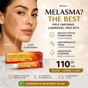 Tratament Melasma, depigmentare intensiva, Triglow, crema depigmentanta, 20g - Img 2