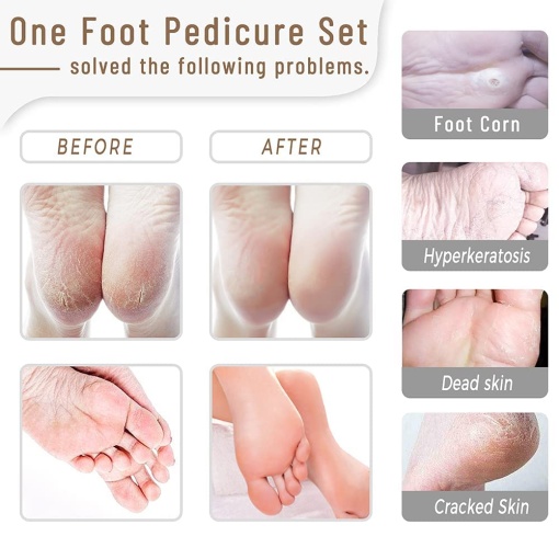 Set complet 30 de Instrumente profesionale pentru pedichiura medicala EBA, otel inoxidabil - Img 2