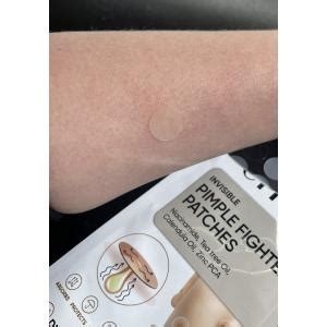 Erne Invisible Pimple Fighter Patches, 24pcs - Img 3